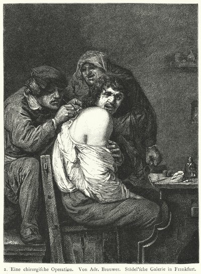 The Back Operation by Adriaen (after) Brouwer