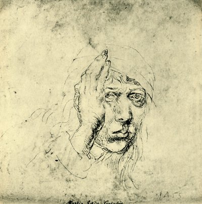 Self Portrait with a Bandage by Albrecht Dürer