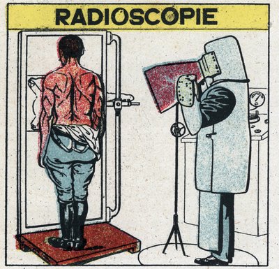 X-rays: radioscopy of a human body. The radiologist protects himself from X-rays by wearing a rubber cloth with a rubber dissolution containing lead salts, his head is covered with a cap and his hands with gloves from the same fabric. by Anonymous Anonymous