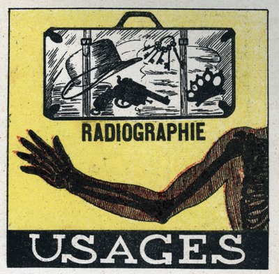 X-rays: use of X-ray to see through objects and bodies. Anonymous illustration from 1925. Private collection. by Anonymous Anonymous