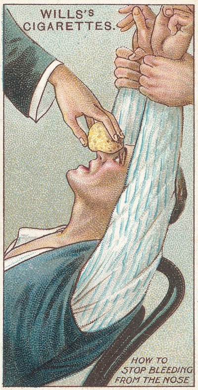 How to Stop Bleeding from the Nose, no.31 from the First Aid series of Wills Cigarettes cards, 1913 by English School