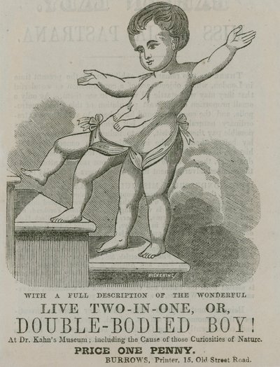 Live Two-in-One, or Double-Bodied Boy by English School