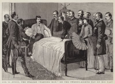 Signor G Succi, the Italian "Fasting Man", on the Twenty-Eighth Day of his Fast by English School