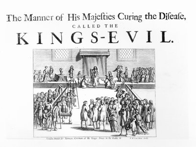 The Manner of His Majesty Curing the Disease Called the King