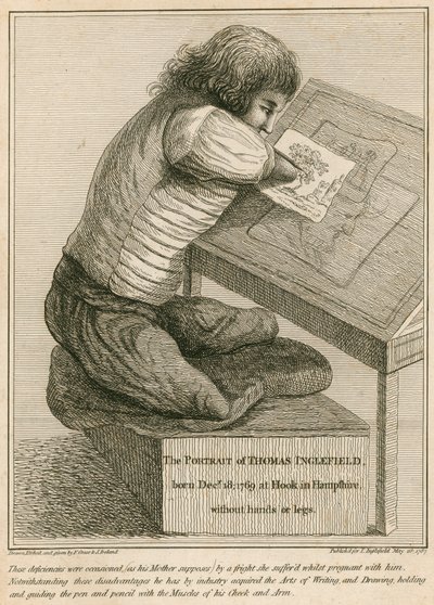 Thomas Inglefield, Born 18 December 1769 at Hook, Hampshire, Without Arms or Legs by English School