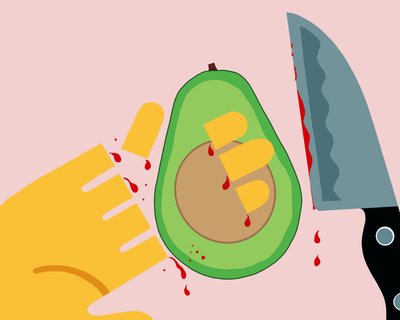 Avocado Hand by Evan Sklar