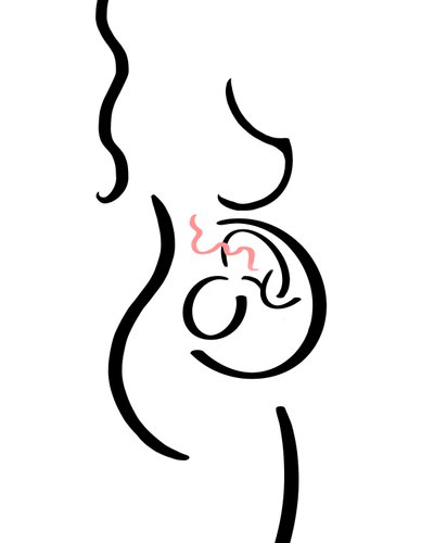 Pregnant by Evan Sklar