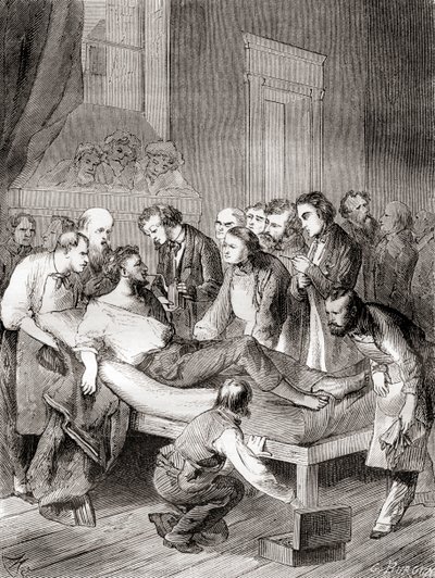 The First Public Demonstration of the Use of Inhaled Ether as a Surgical Anaesthetic in 1846 by William Thomas Green Morton by French School