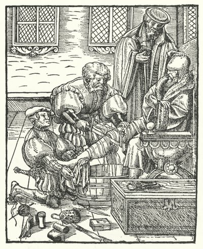 An Amputation by German School