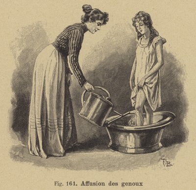 Bathing the Knees by German School