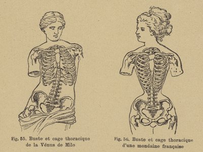 Comparison of the shape of the chest and ribcage of the Venus de Milo with that of a late 19th Century French socialite by German School