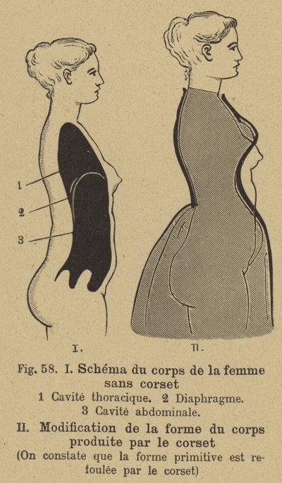 Diagram showing the effect of wearing a corset on the shape of a woman