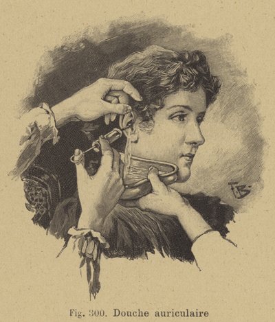 Ear Irrigation by German School