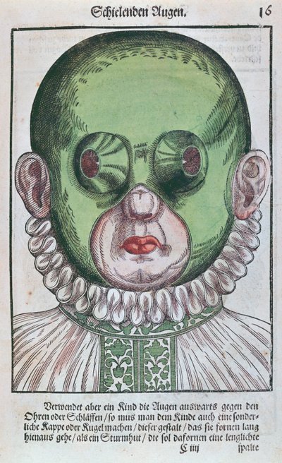 Mask for Treating a Strabismus, from Ophthalmodouleia by Georg Bartisch, published in Dresden in 1583 by German School