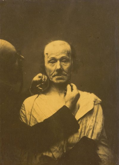 Attention, 1854-1856, Printed 1862 by Guillaume-Benjamin-Armand Duchenne de Boulogne