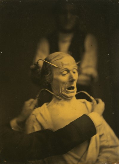 Expression of Terror, 1854-1856, Printed 1862 by Guillaume-Benjamin-Armand Duchenne de Boulogne