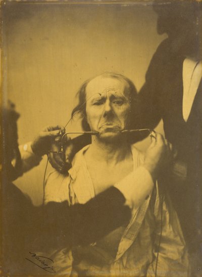 Pain and Despair, 1854-1856, Printed 1862 by Guillaume-Benjamin-Armand Duchenne de Boulogne