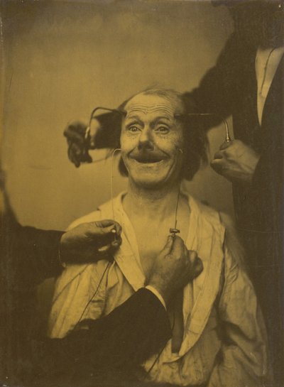 A False, Incomplete Expression of Agreeable Surprise, or Admiration by Guillaume Benjamin Amant Duchenne