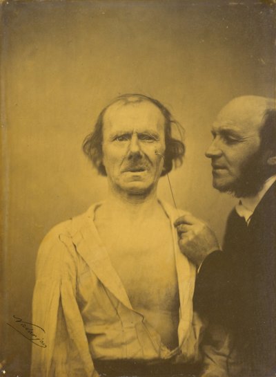 Weeping, tears of pity (left); Relaxed face (right) by Guillaume Benjamin Amant Duchenne