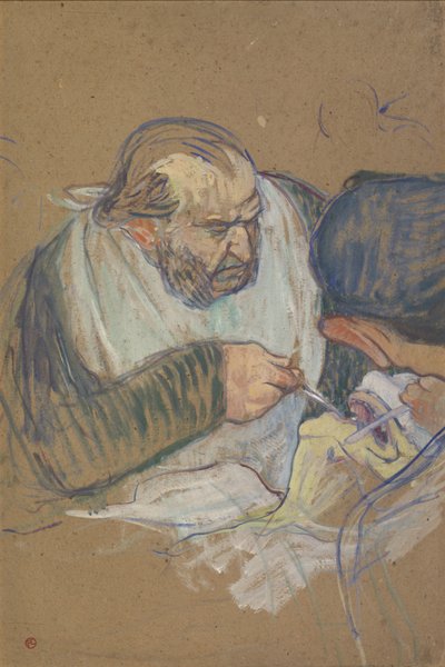 Dr. Péan Operating, 1891-92 by Henri de Toulouse Lautrec