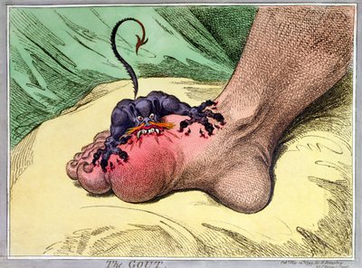 The Gout, published by Hannah Humphrey in 1799 by James Gillray