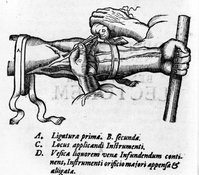 Anatomical board: different ligatures. Work on the blood system by William Harvey (1578-1657), English doctor. He described the circulation of blood in the body through the veins by Unknown artist