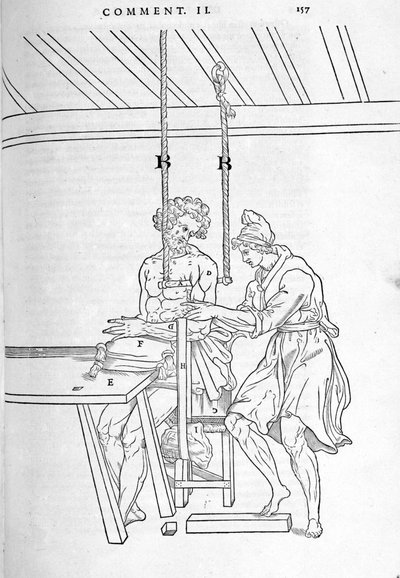 Reduction of fractures (plate illustrated from 