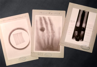 Original Radiographies by Roentgen by Wilhelm (after) Röntgen