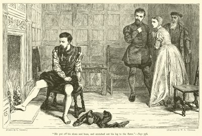 He put off his shoes and hose, and stretched out his leg to the flame by after Charles Green