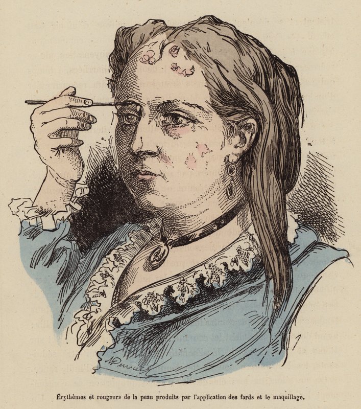 Woman with Skin Rashes and Redness Caused by the Use of Make-Up by (after) French School