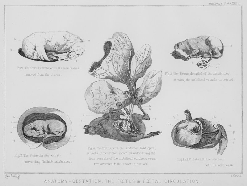 Anatomy, Gestation, the Fetus and Fetal Circulation by Benjamin Herring