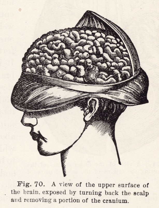 A view of the upper surface of the brain, exposed by turning back the scalp and removing a portion of the cranium by English School