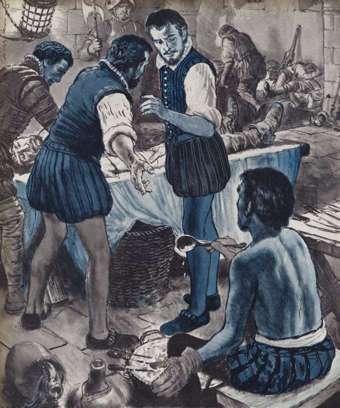 Ambroise Pare, Military Surgeon, When the Oil Ran Out by English School