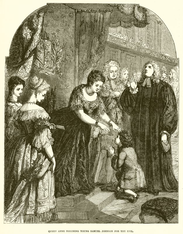 Queen Anne Touching Young Samuel Johnson for the Evil by English School