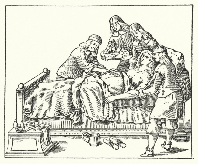 A Caesarean operation in the seventeenth century by European School