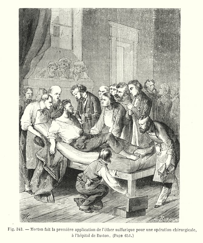 Morton makes the first application of sulfuric ether for a surgical operation, at the Boston hospital by European School