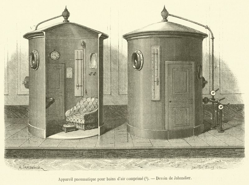 Pneumatic Apparatus for Compressed Air Baths (engraving) by French School