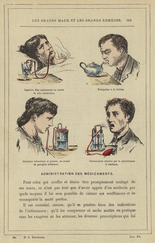 Ingestion of a Medication Using a Feeding Tube, Teapot Fumigation, Balsamic and Gaseous Inhalation Using a Gasogene Inhaler, Reactive Spraying by the Reaction Sprayer by French School