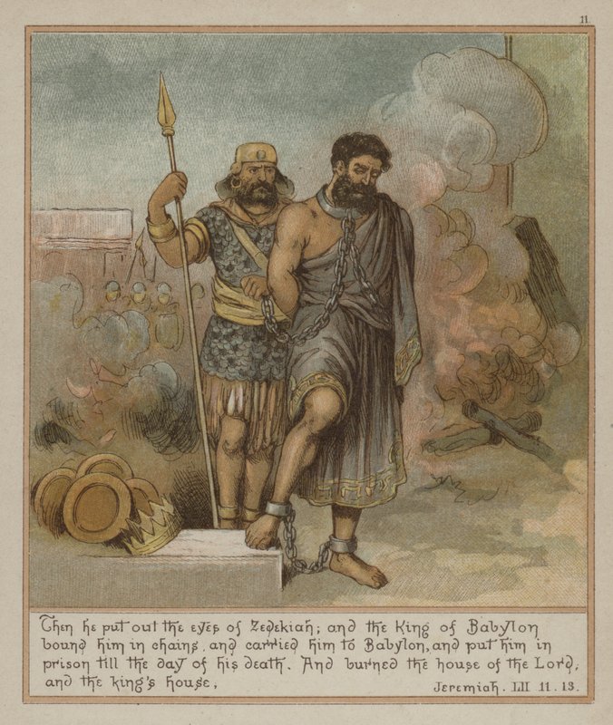 Then He Put Out the Eyes of Zedekiah by Richard Andre