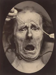 Electro-Physiologie, Figure 64