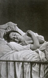 Young Woman Having a Fit of Hysteria, 1878