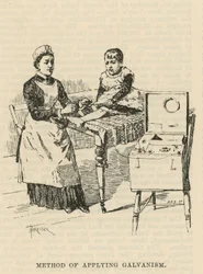 The West End Hospital for Paralysis and Epilepsy, Welbeck Street, London: Method for Applying Galvanism