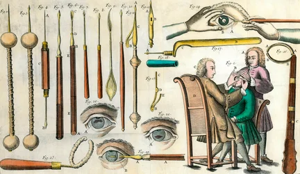 Surgery in the 18th century: eye operation. Instruments for cataract operation and artificial pupil formation. Engraving in 