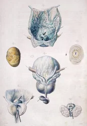 Diseases of the bladder and prostate, from 