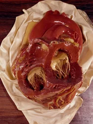 Model of a Heart