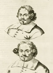 An example of cupping, from Exercitationes Practicae circa Medendi Methodum by Frederik Dekkers, 1694