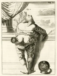 An example of cupping, from Exercitationes Practicae circa Medendi Methodum by Frederik Dekkers, 1694