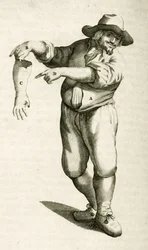 Removing dead skin with pustules, from Exercitationes Practicae circa Medendi Methodum by Frederik Dekkers, 1694
