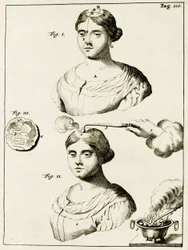 Treating a sufferer of Epilepsy, from Exercitationes Practicae circa Medendi Methodum by Frederik Dekkers, 1694