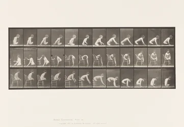 Double Amputation of Thighs; Boy; Moving Forward (Plate 538)